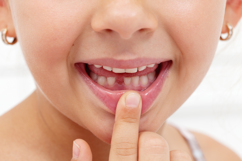 A Parent s Guide To Losing Baby Teeth Hoffman Dental Care