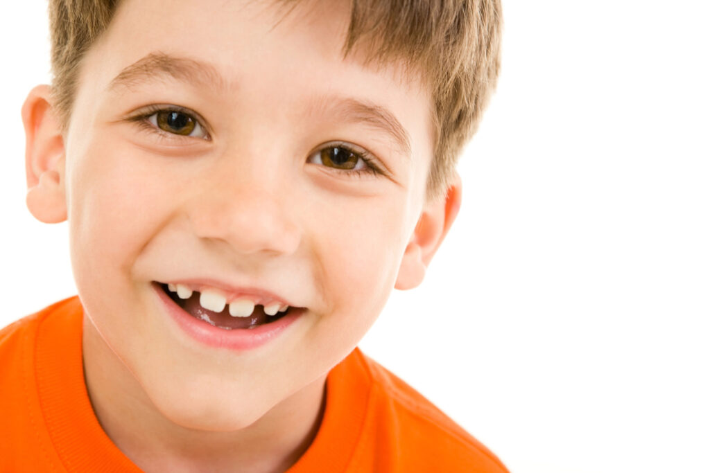 Why Are My Child's Teeth Yellow? - Hoffman Dental Care