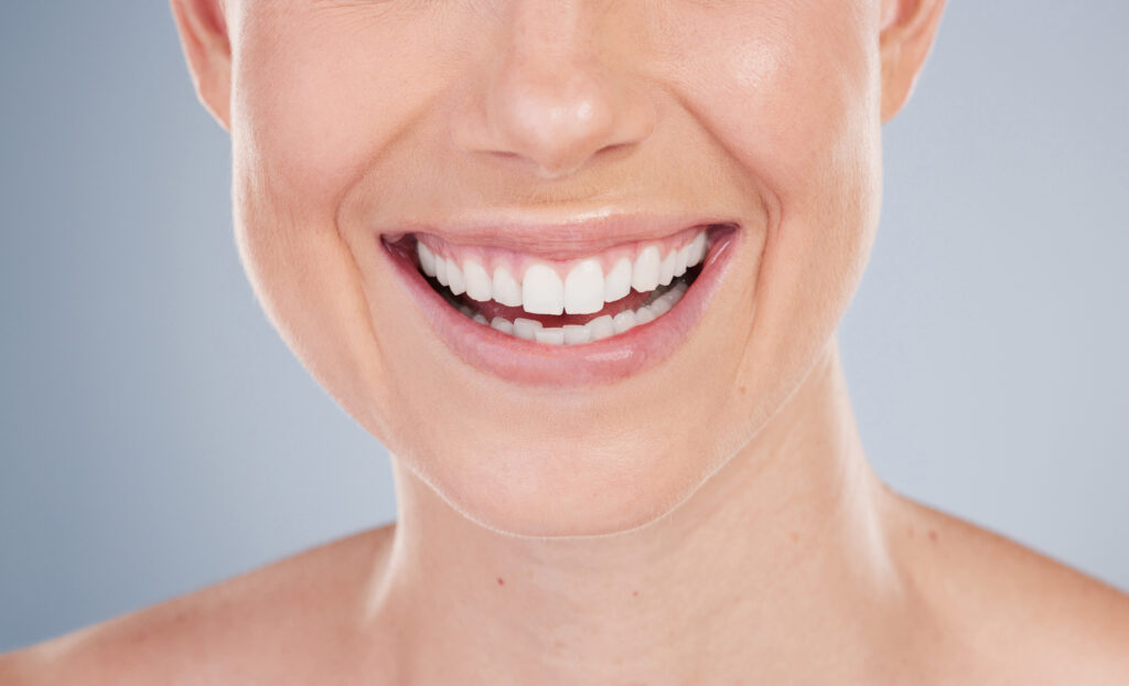 Close up of woman's smiling teeth and gums