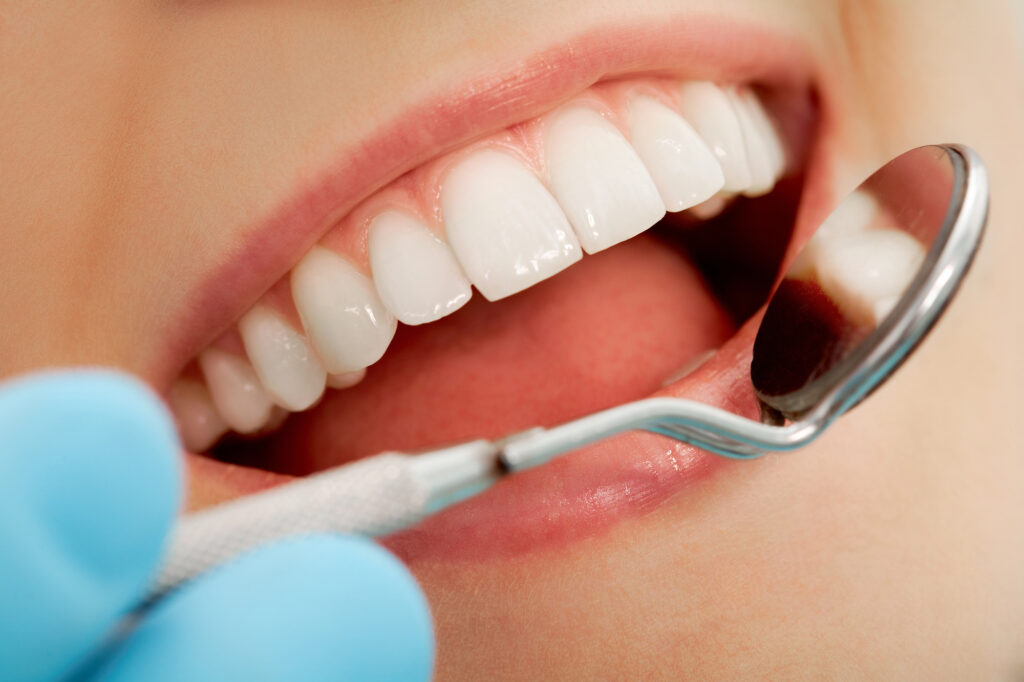 Close up of dentist checking for tooth decay.